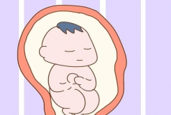 為什么剖腹產(chǎn)出生的孩子更容易感統(tǒng)失調(diào)